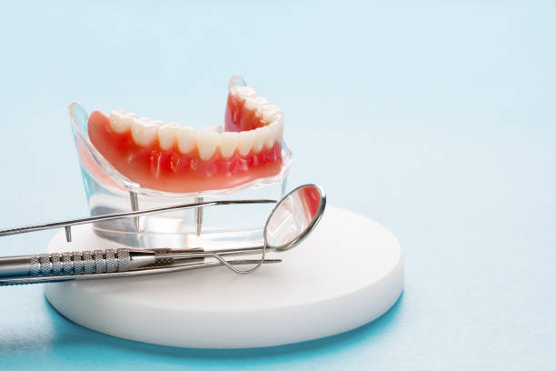 Full Mouth Reconstruction in Watertown, SD